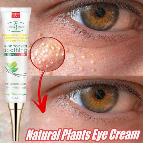 Fat Granules Remover Eye Cream Anti-puffiness Wrinkles Cream Lift