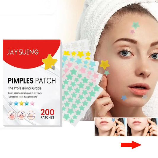 200pcs/set Invisible Acne Pimple Patch Professional Face Skin Care