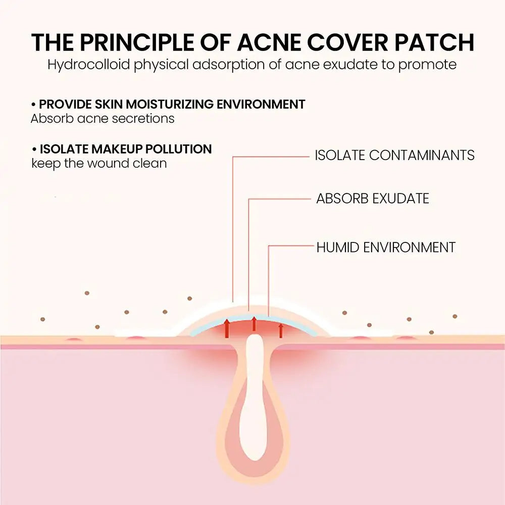 200pcs/set Invisible Acne Pimple Patch Professional Face Skin Care