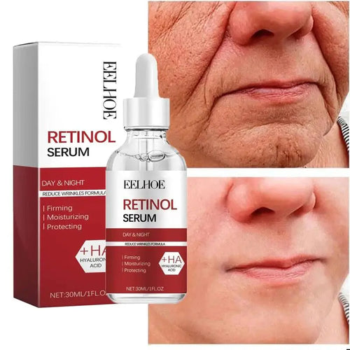 Retinol Wrinkle Remover Face Set Instant Firming Lifting Anti-Aging