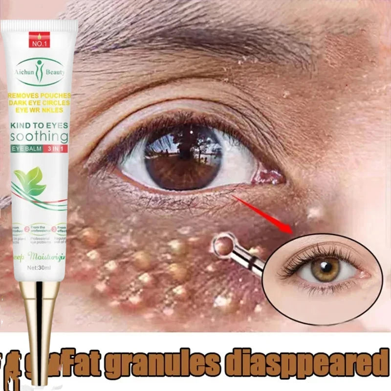 Fat Granules Remover Eye Cream Anti-puffiness Wrinkles Cream Lift